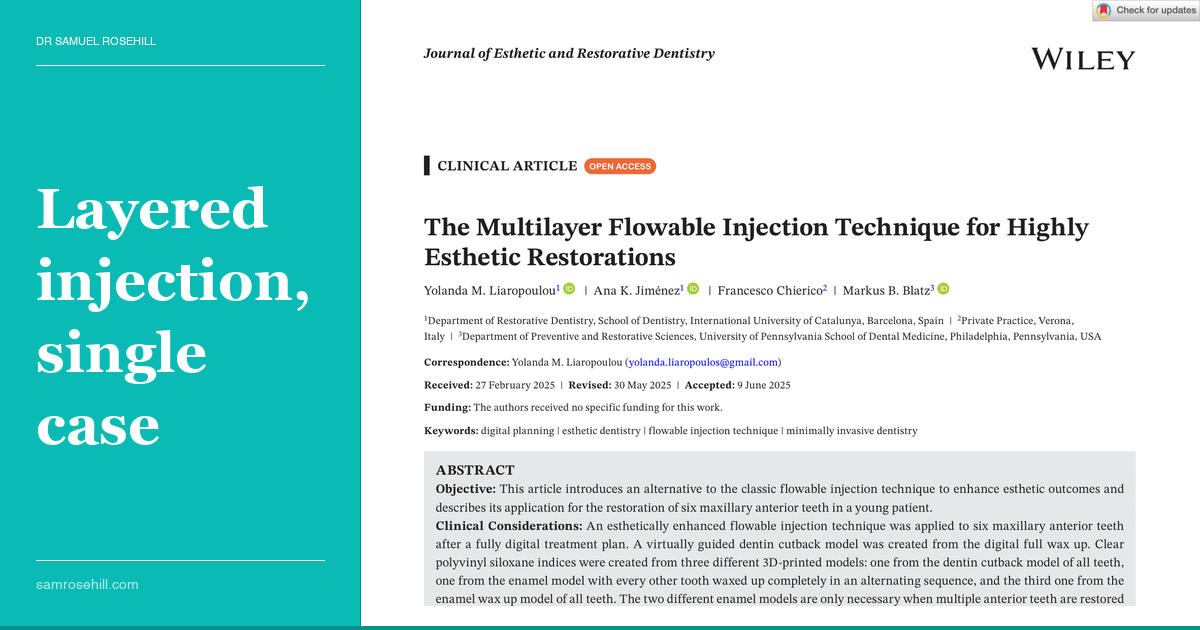 The Injection Technique That Forgot to Have Layers