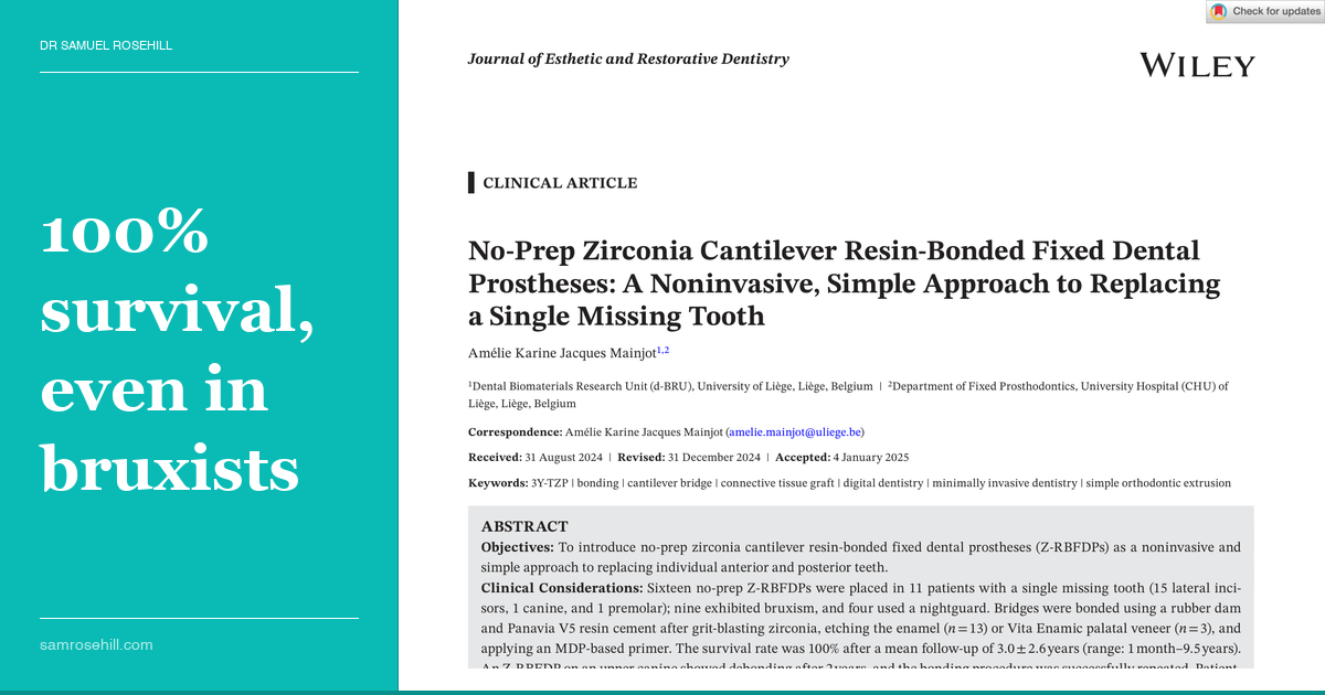 No Drill, No Implant: Zirconia Bonded Bridges Hold Up Even in Bruxists